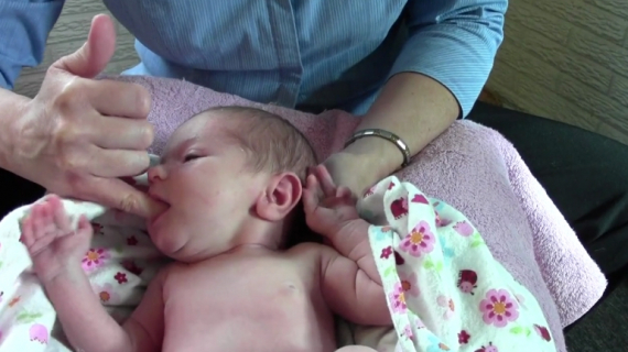 Breastfeeding with a Tongue Tie Baby