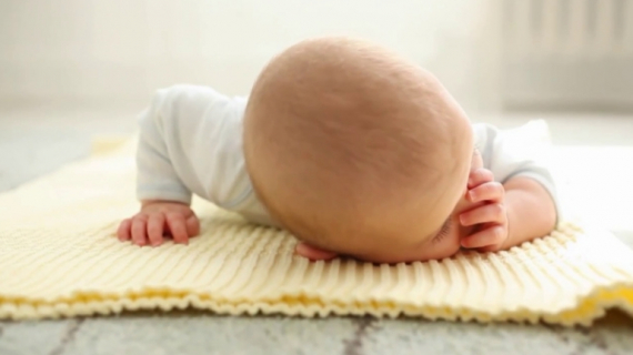 Cradle Cap (Seborrheic Dermatitis in Babies)