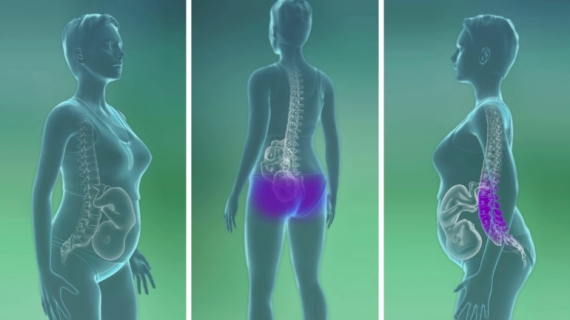 Definition of Pregnancy Back Pain