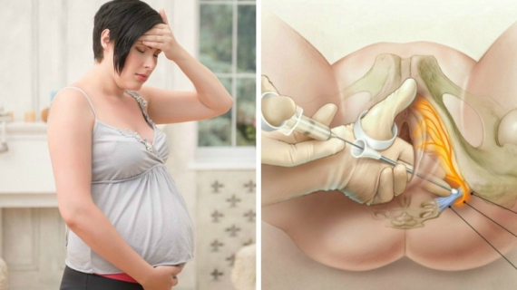 Different Pain Relief Options During Labour and Birth