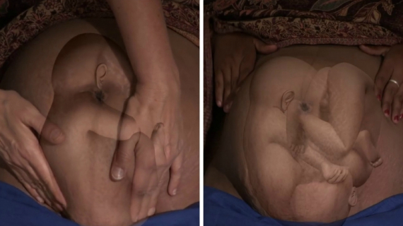 Different Positions of a Baby in the Womb