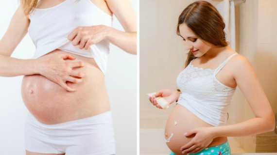 DIY Pregnancy Body Oil