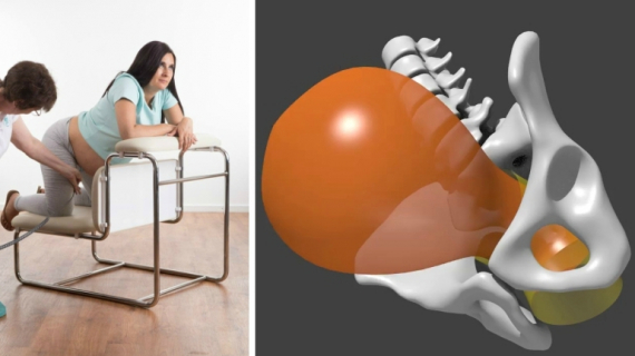 Dynamic Positions in Birth: Upright Position Can Make Delivery Easier