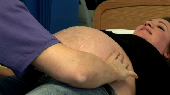 External Cephalic Version Technique for Breech Baby