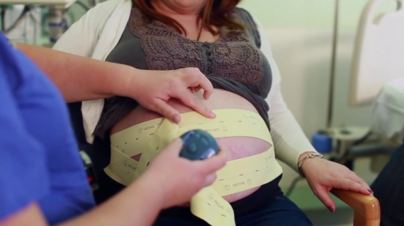 Fetal Monitoring During Labor (VBAC)