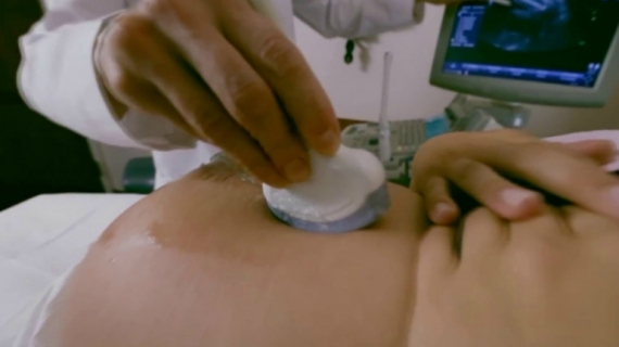 First Trimester Screening