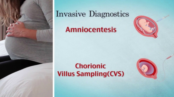 Genetic Screening and Testing During Pregnancy