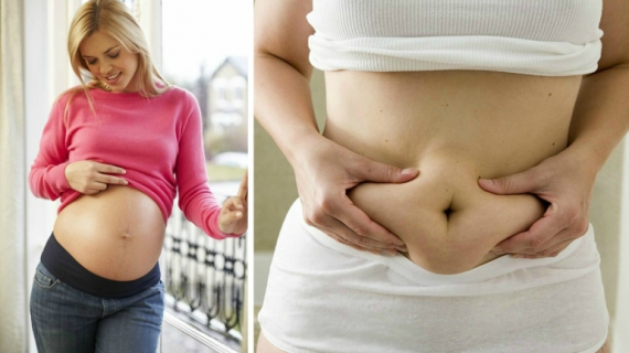 Getting Your Pre-Pregnancy Body Back