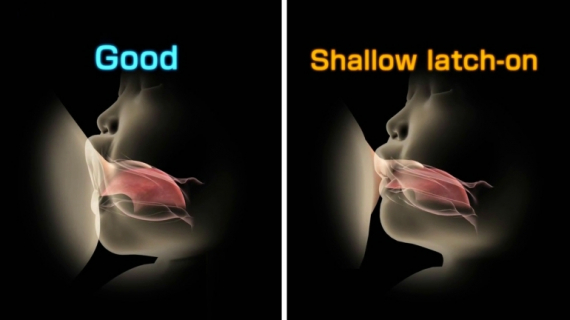 How a Baby Latches on a Mother's Nipple During Breastfeeding