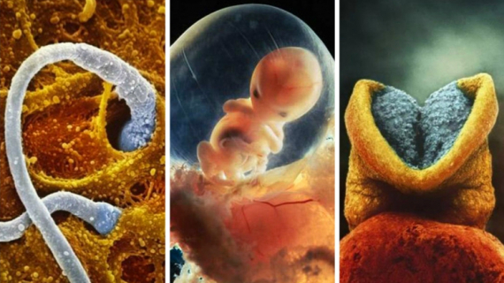 How a Child is Born: Incredible Photos of a Baby Developing in the Womb How a Child is Born: Incredible Photos of a Baby Developing in the Womb