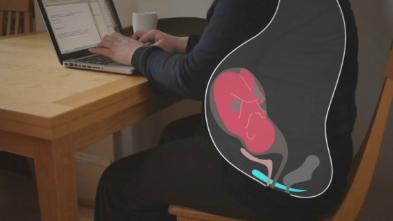 How and When I Should Do Pelvic Floor Exercises?