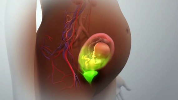 How Does Prenatal Radiation Exposure Affect Unborn Babies?