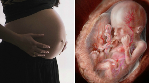 How Rh Factor Affects a Pregnancy