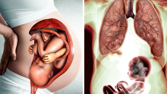 How Smoking Affects Your Baby During Pregnancy?