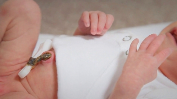 How to Care for Your Newborn Baby’s Umbilical Cord Stump?