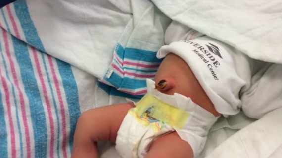 How to Clean Baby's Umbilical Cord?