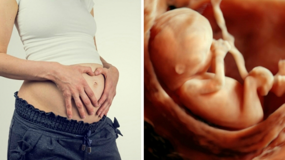 How to Predict Your Baby Gender at 13 Weeks