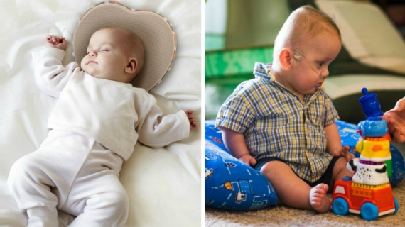 How to Prevent Infant Flat Head Syndrome?