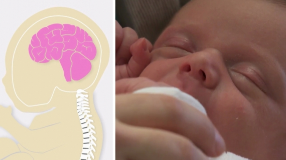 How to Prevent Shaken Baby Syndrome?