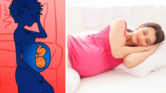 How to Sleep Safely During Pregnancy?