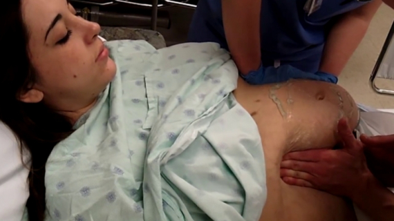 How to Turn a Breech Baby? (External Cephalic Version)