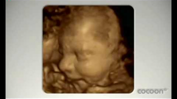 3D/4D baby scan - Anna's Pregnancy Diary: Week 28