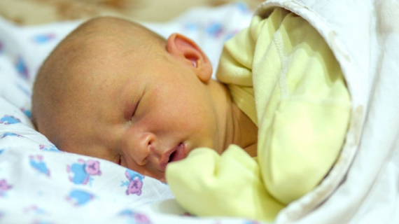 Importance of Jaundice Treatment in Newborns