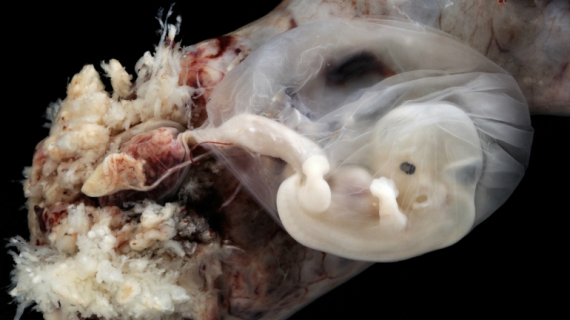 Incredible Real Photos of the Human Developing in the Womb