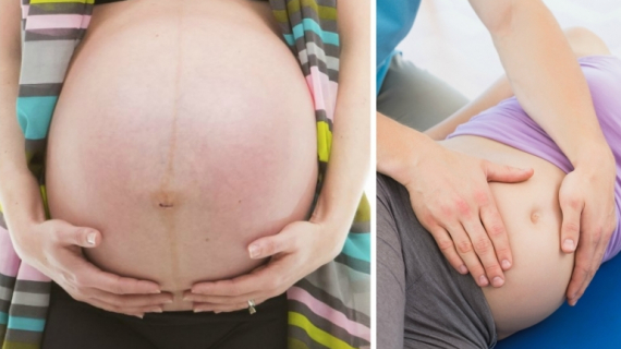 Induce Labor: Ways to Help Pregnant Women Dilate