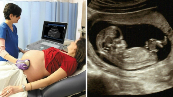 Is it a Boy or Girl: 8 Common Gender Prediction Methods