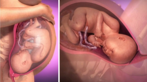 Labor and Vaginal Delivery