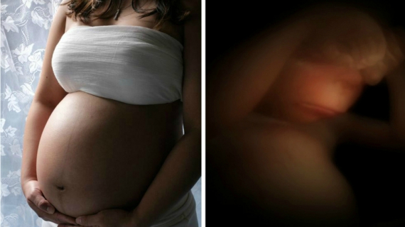 Life in the Womb: Hands, Feet and Proprioception