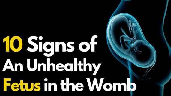 10 Signs of an Unhealthy Fetus 
