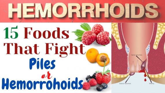 15 Helpful Foods for Hemorrhoids