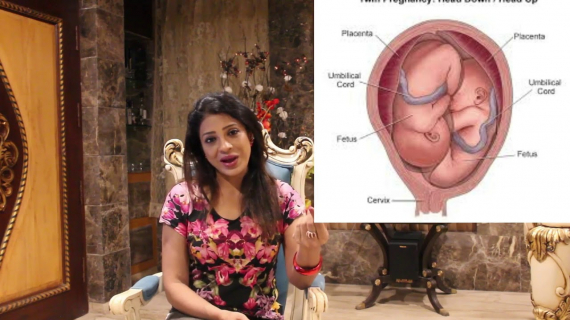 Problems & complications in twin pregnancy