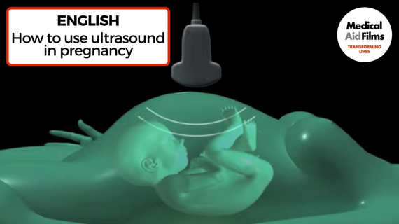 How to use ultrasound in pregnancy