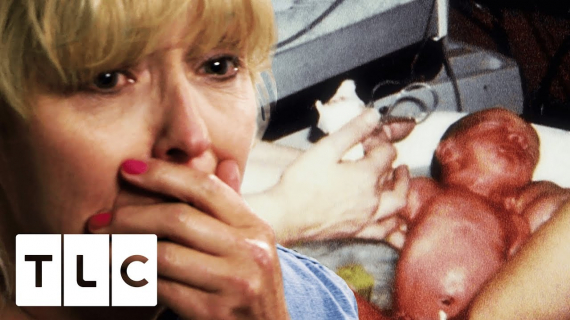 Doctor Mistakes Pregnancy for Glaucoma