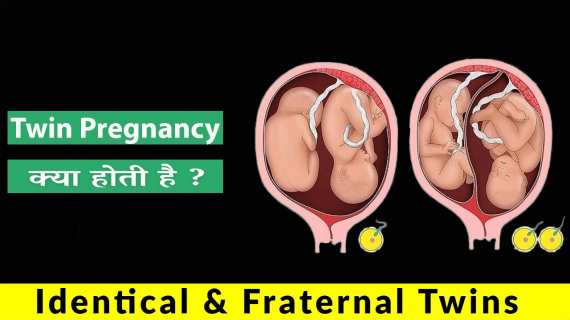 How is the pregnancy of twins?
