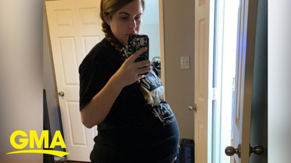 Texas mom survives deadly brain surgery while pregnant, then has quadruplets