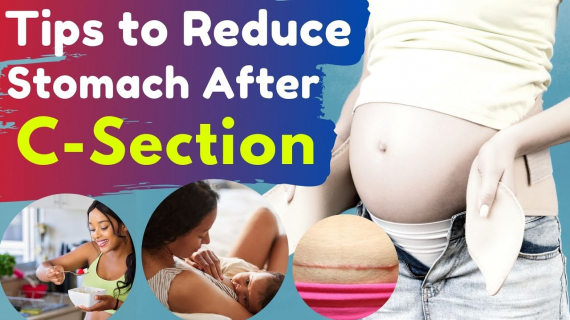 How to lose belly Fat After Pregnancy 