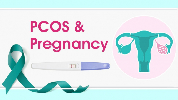 PCOS and Pregnancy