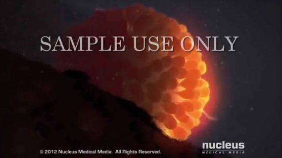 Fertilization (Conception)