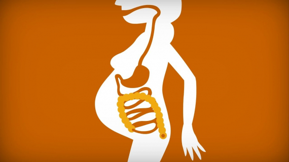 Constipation during pregnancy