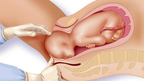 Mechanism of Normal Labour and Vaginal Delivery