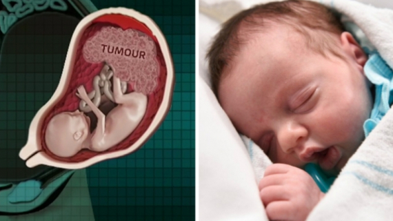 Medical Miracle: Baby is 'Born Twice' at Texas Hospital