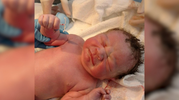 Mom Gives Birth to a Baby After IUD Birth Control Device Fails