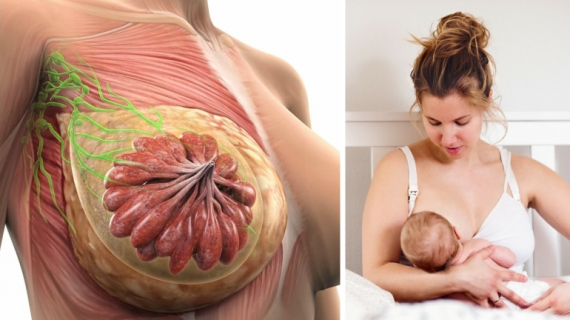 Natural Remedies for Clogged Milk Duct