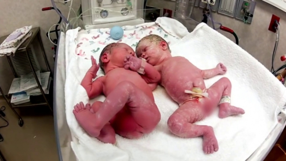 Newborn Twins First Meeting