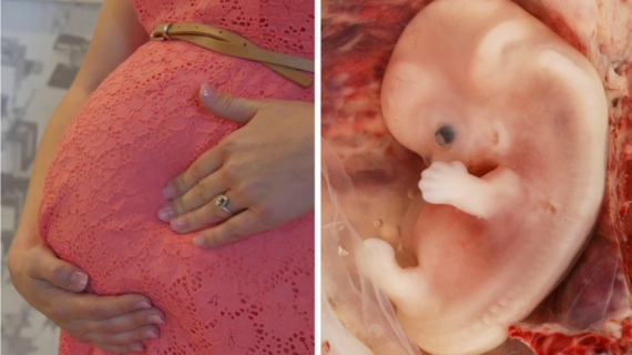 Normal Fetal Movement and Growth