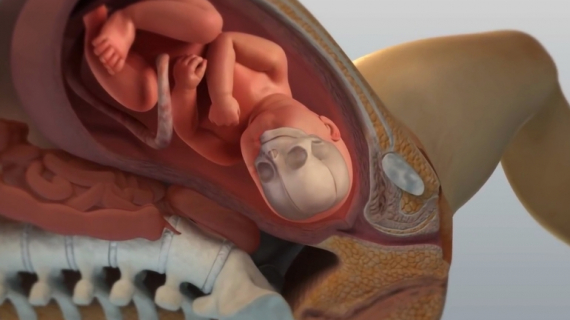 Normal Spontaneous Vaginal Delivery